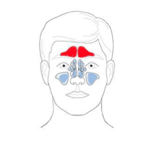 Sinuses